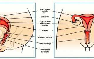 Гистеросальпингография (ГСГ) маточных труб — что это такое в гинекологии