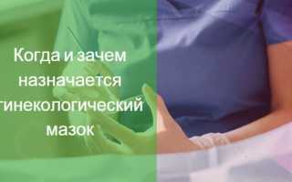 Зачем нужен соскоб из полости матки на гистологию?
